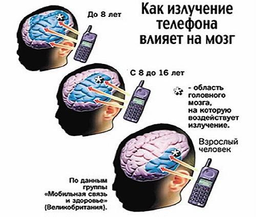 Мобильный телефон и рак мозга